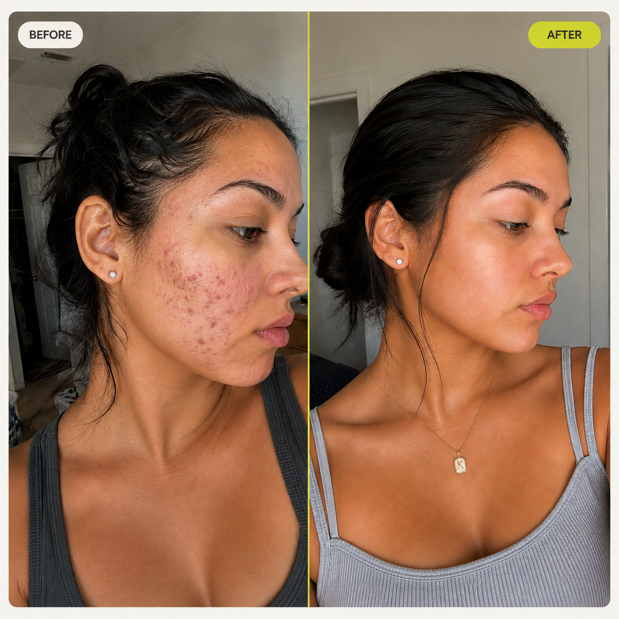 CLARIYA Targeted Dark Spot Serum — 1% Kojic Acid — image 8
