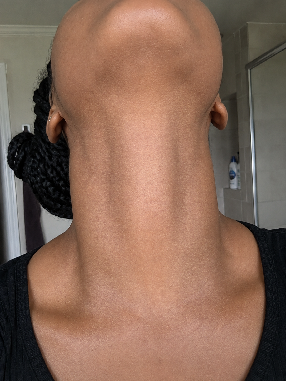 Before and after — twelve weeks of consistent use.