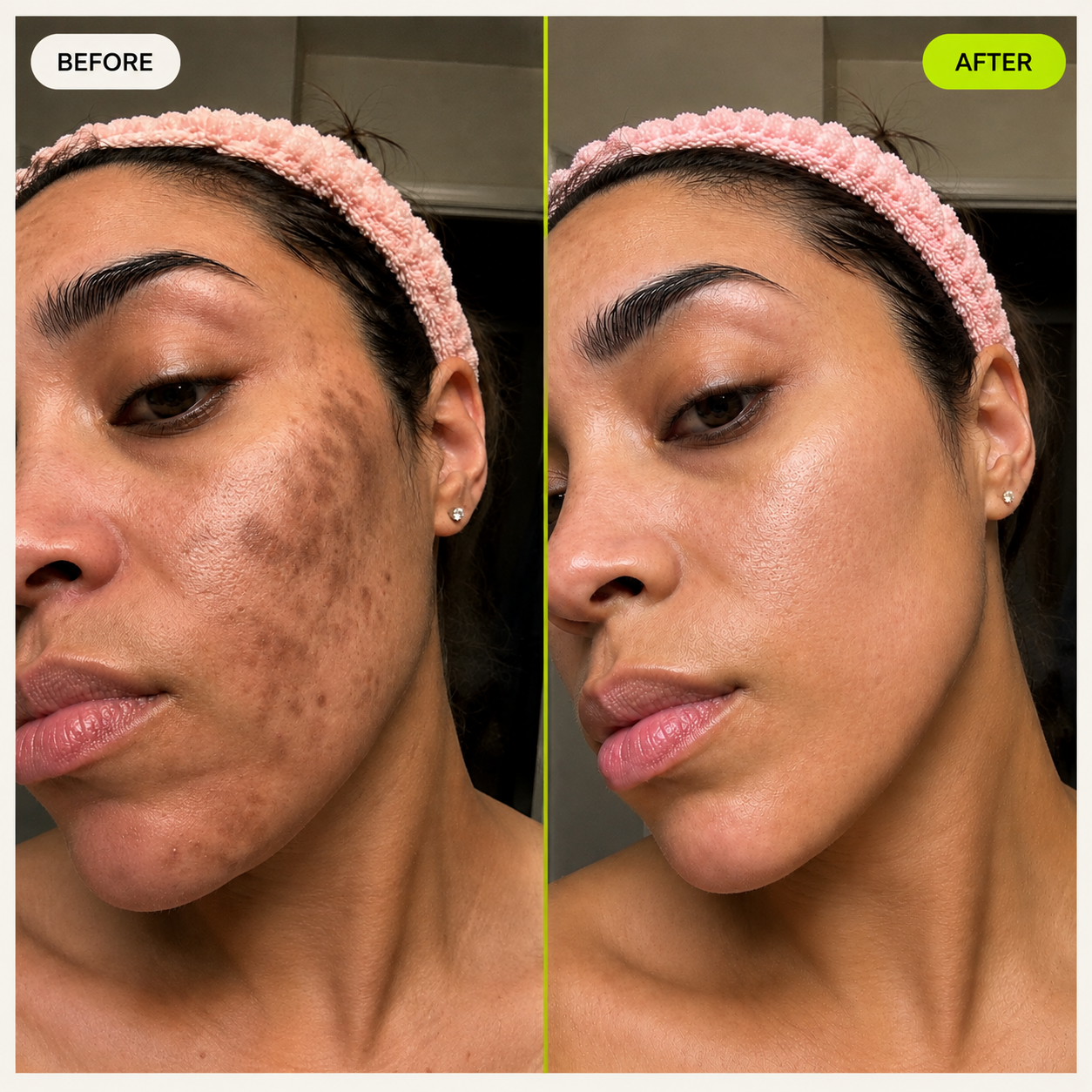 CLARIYA Targeted Dark Spot Serum — 1% Kojic Acid — image 7